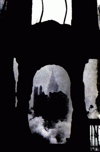 Nameless (COL) : Across The Threshold